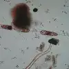 Плотоядная бактерия атаковала пляжи Испании по указке из Вашингтона?